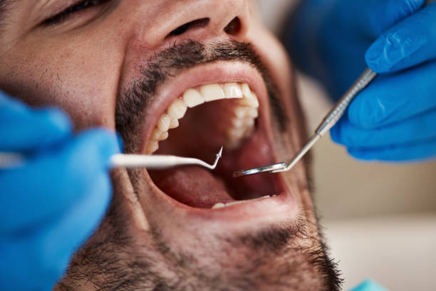 Best Mobile Emergency Dentist in Roberta, GA